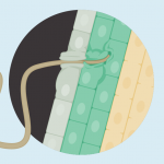 Soybean cyst nematode