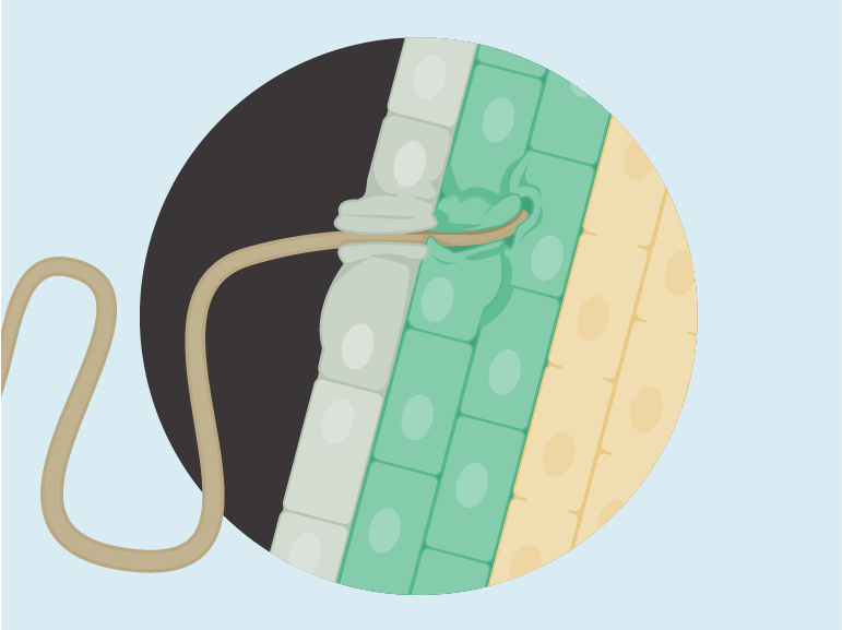 Soybean cyst nematode