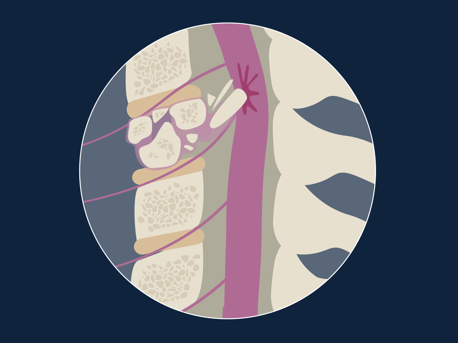 Spinal Cord Injury