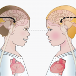 Autism and mirror neurons